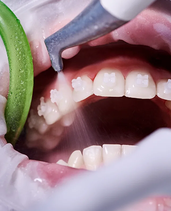 Periodontoloji
